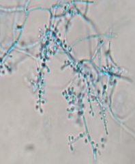 Identify
A.Trichophyton verrucosum
B.Malassezia
C.Trichophyton rubrum
D.Trichophyton mentagrophytes