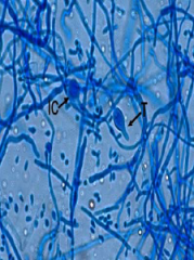 Identify
A.Microsporum audouinii
B.Microsporum gypseum complex
C.Malassezia
D.Trichophyton rubrum