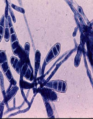 Identify
A.Microsporum gypseum complex
B.Trichophyton mentagrophytes
C.Epidermophyton floccosum
D.Malassezia