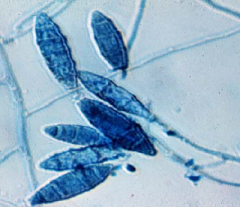 Identify
A.Trichophyton verrucosum
B.Malassezia
C.Microsporum gypseum complex
D.Microsporum audouinii