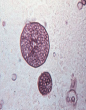 Identify from direct exam
A.Histoplasma capsulatum
B.Coccidioides immitis
C.Rhodotorula rubra
D.Blastomyces dermatitidis