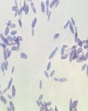 Identify from direct exam
A.Paracoccidioides brasillensis
B.Histoplasma capsulatum
C.Sporothrix schenckii
D.Blastomyces dermatitidis