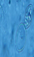 Identify from direct exam
A.Blastomyces dermatitidis
B.
Penicillium marneffei


C.Paracoccidioides brasillensis
D.Histoplasma capsulatum
