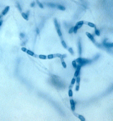 Identify 
A.Blastomyces dermatitidis
B.Sporothrix schenckii
C.
Histoplasma capsulatum


D.Coccidioides immitis