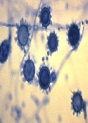 Identify
A.Histoplasma capsulatum
B.Blastomyces dermatitidis
C.Coccidioides immitis
D.Penicillium marneffei
