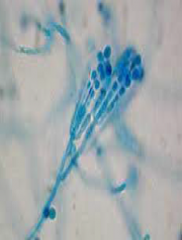 Identify
A.Coccidioides immitis
B.Penicillium marneffei
C.Blastomyces dermatitidis
D.Sporothrix schenckii