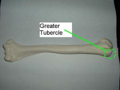 term tubercle may describe a round nodule, small eminence, or warty outgrowth found on bones