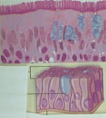 This set of cells has "little hairs" on the top of it. It is _____  ______ ____