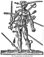 Its everything that a surgeon could deal with, the only thing a surgeon couldnt deal with was the plague. However after being treated they would probably die of infection.
