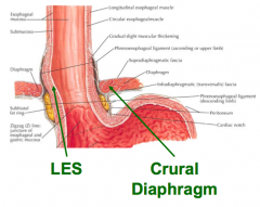 - LES
- Crural diaphragm