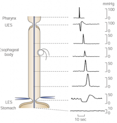 UES relaxes, which decreases the pressure, allowing bolus to pass through