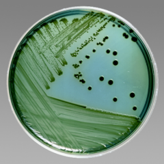 -Differentiates  Salmonella and Shigella


-Shigella = green colonies


-Salmonella = colonies with black centers