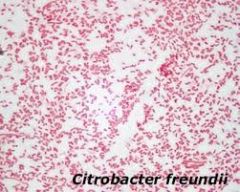 Citrobacter freundii