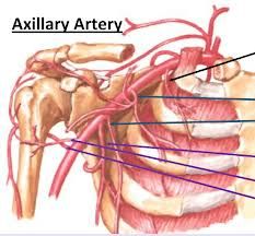 What artery is the top blue arrow pointing to?