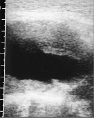 what does this longitudinal image demonstrate?