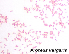 Proteus vulgaris