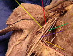 What nerve is indicated in yellow?