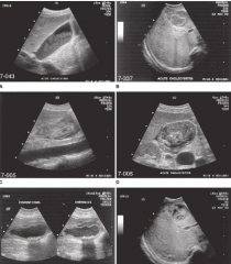 what is shown here?
 
describe clinical signs and sonographic signs