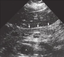 identify whether this image is transverse or longitudinal and what the arrows are pointing to