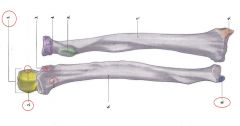 Neme these 5 structures on ulna.