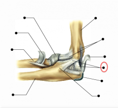 What ligament is this?