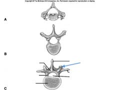 Name these 5 structures of the vertebrae.

What is the blue arrow pointing to?