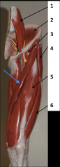 What muscle is the blue arrow pointing to?