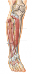 Which branch of the peroneal nerve is the top arrow pointing to?