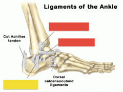 Red boxes represent what ligament?