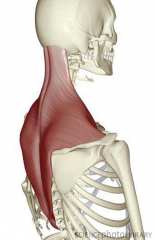 Diamond Shape muscle, most superior and most superficial muscle of the back

PA:external occipital protuberance, nuchal ligament, spinous processes of C7-T12
DA: Lateral 1/3 of clavicle (anteriorly), acromion, and spine of scapula

Action: el...