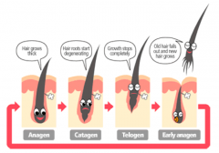 Resting phase (TELOGEN)
- Hair shed during this phase (about 100-200 hairs)
- 3 months
- 10-15% of hair on scalp