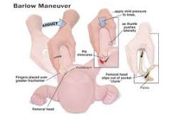what is the barlow maneuver?
