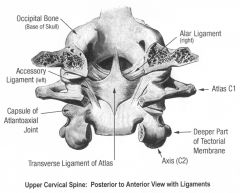 U-shaped ligament surrounding odontoid to prevent posterior translation (attaches axis to atlas and occiput)