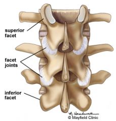 Articulation; A smooth, flat, slightly concave or convex articular surface (ex: artifular facets of the vertebrae)