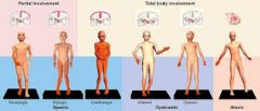 what is dyskinetic CP?