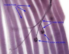 A single axon and all of the muscle fibers that it innervates
