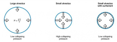Larger alveolus -> low collapsing pressure
Small alveolus -> high collapsing pressure
Small alveolus + Surfactant -> low collapsing pressure