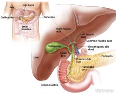 The common bile duct is where the cystic duct and common hepatic duct lead into. 

A gallstone lodged in this duct is called choledocholithiasis.
