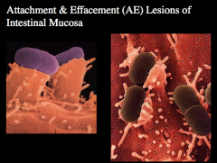 How does E. coli cause the abdominal cramps and non-bloody diarrhea seen at the onset of infection?