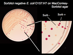 Identifying E. coli on McConkey-Sorbital plate