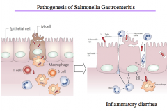 Pathogenesis of Salmonella Gastroenteritis