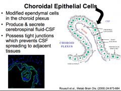 Ependymal Cells (CNS)

*function to produce and secrete CSF!*