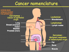 cancer of epithelial origin (e.g. skin, lung, breast, colon, bladder)