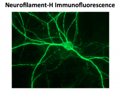 What role does a neuron's cytoskeleton play? What is it composed of?