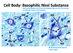 Polyribosomes, free ribosomes, and RER stain basophilic ally and appear as nissl bodies (the grainy, blue staining patterns.

The axon hillock is the only part of the cell body that is devoid of nissl bodies.