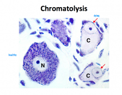 What is Chromatolysis?