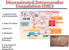 DESCRIBE disseminated intravascular coagulation as a complication for major disorders.