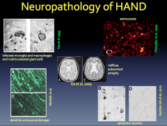HAND Classification and Clinical Manifestation