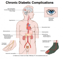 Chronic Complications of DM
