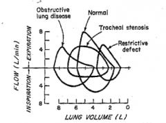 The obstructed patient will have:
1. Increased overall lung volume
2. Decrease inspiratory/expiratory flow